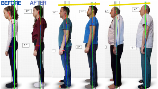 How Improving Posture Could Do A lot More Than Just Relieve Pain